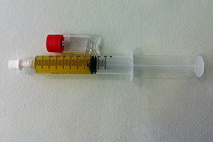 Plasma rico en plaquetas (PRP)